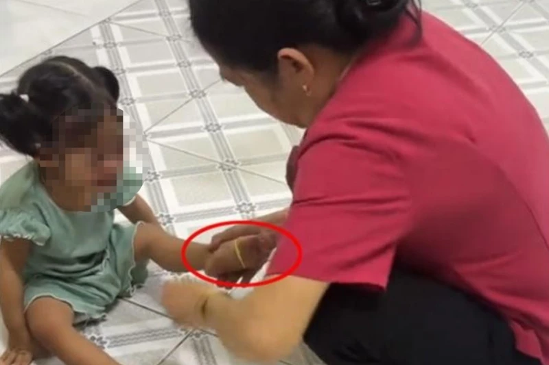 Công an xác minh vụ bảo mẫu đánh chửi, bắn dây thun vào trẻ