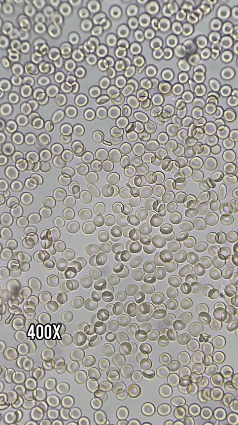 Red blood cells revealed in stunning microscopic detail