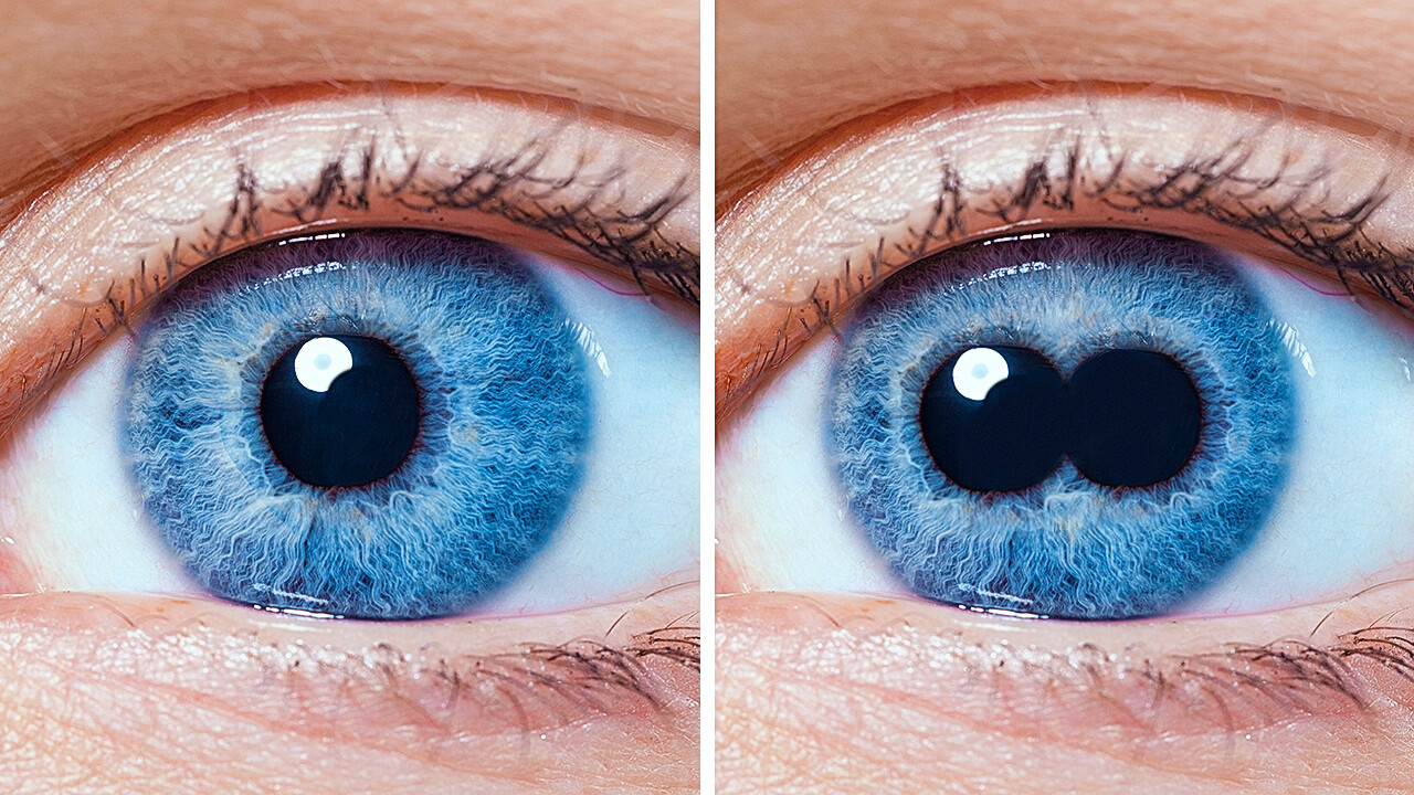 Unbelievable Human Body Oddities You Won't Believe