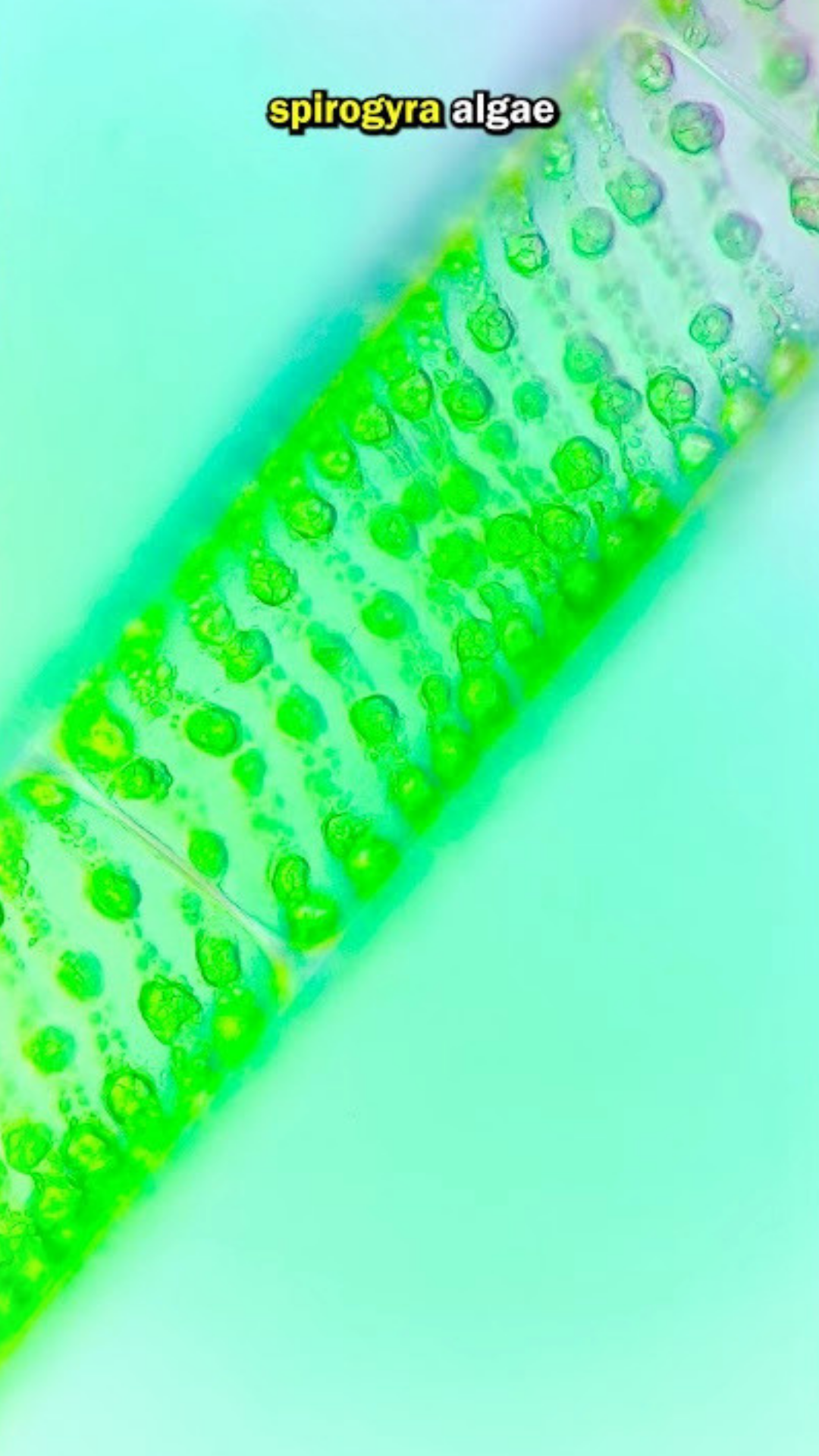 What lives in pond water? Algae under microscope?