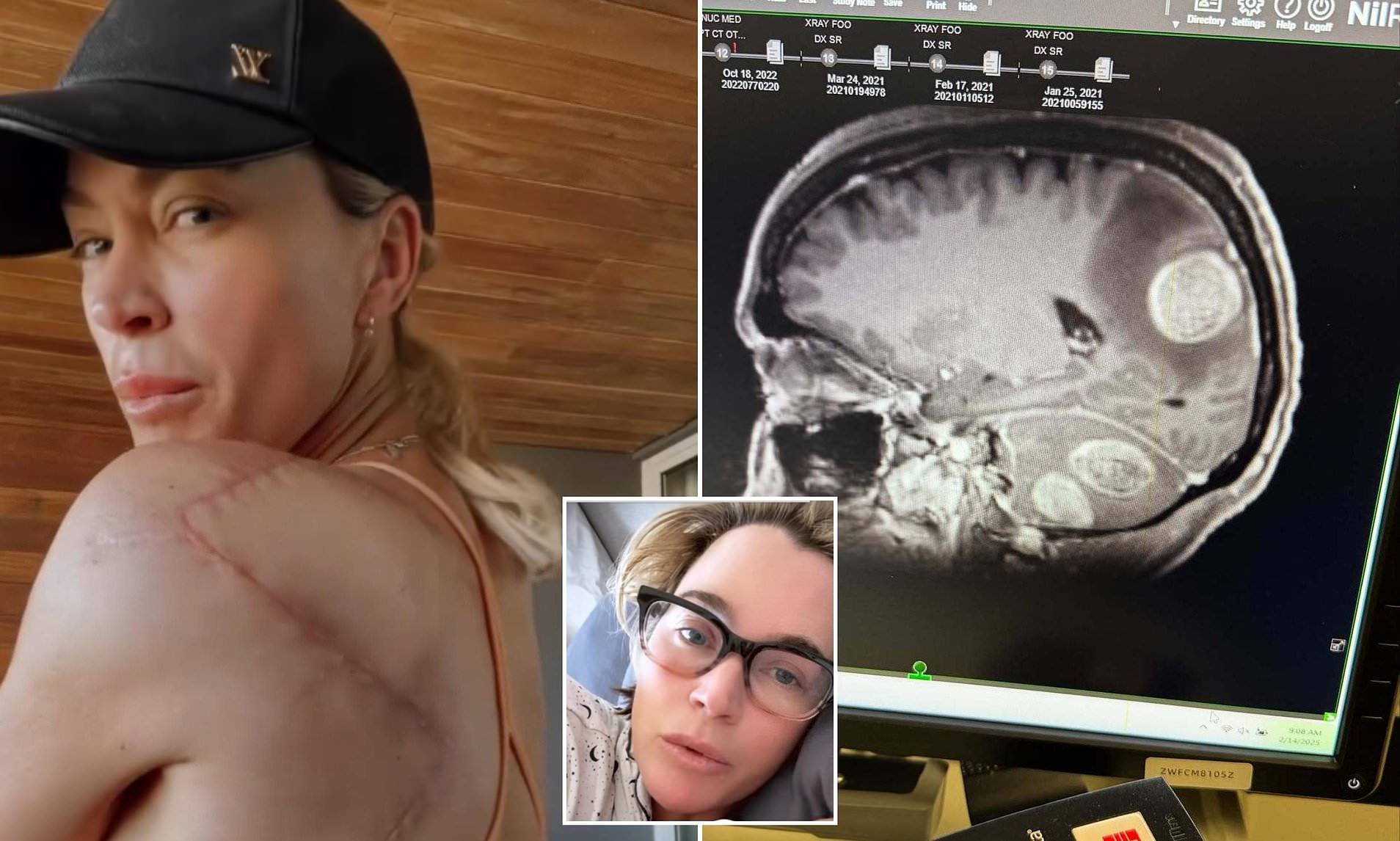 Teddi Mellencamp reveals she has nine months of cancer treatments left