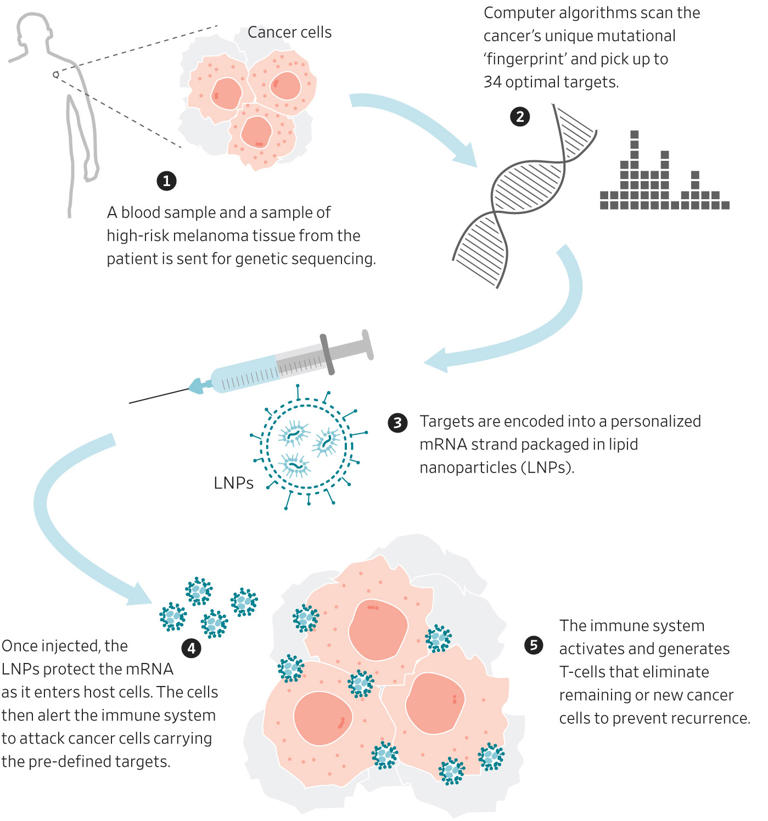 Moderna’s Cancer Vaccine Success Doesn’t Live Up to Early Hype