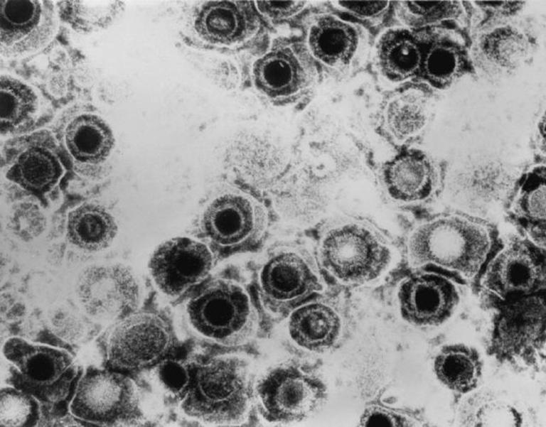 The dementia vaccine some of us are taking without realising