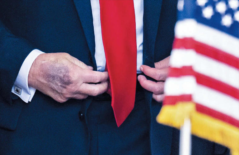 melania trump weight gain Image 5