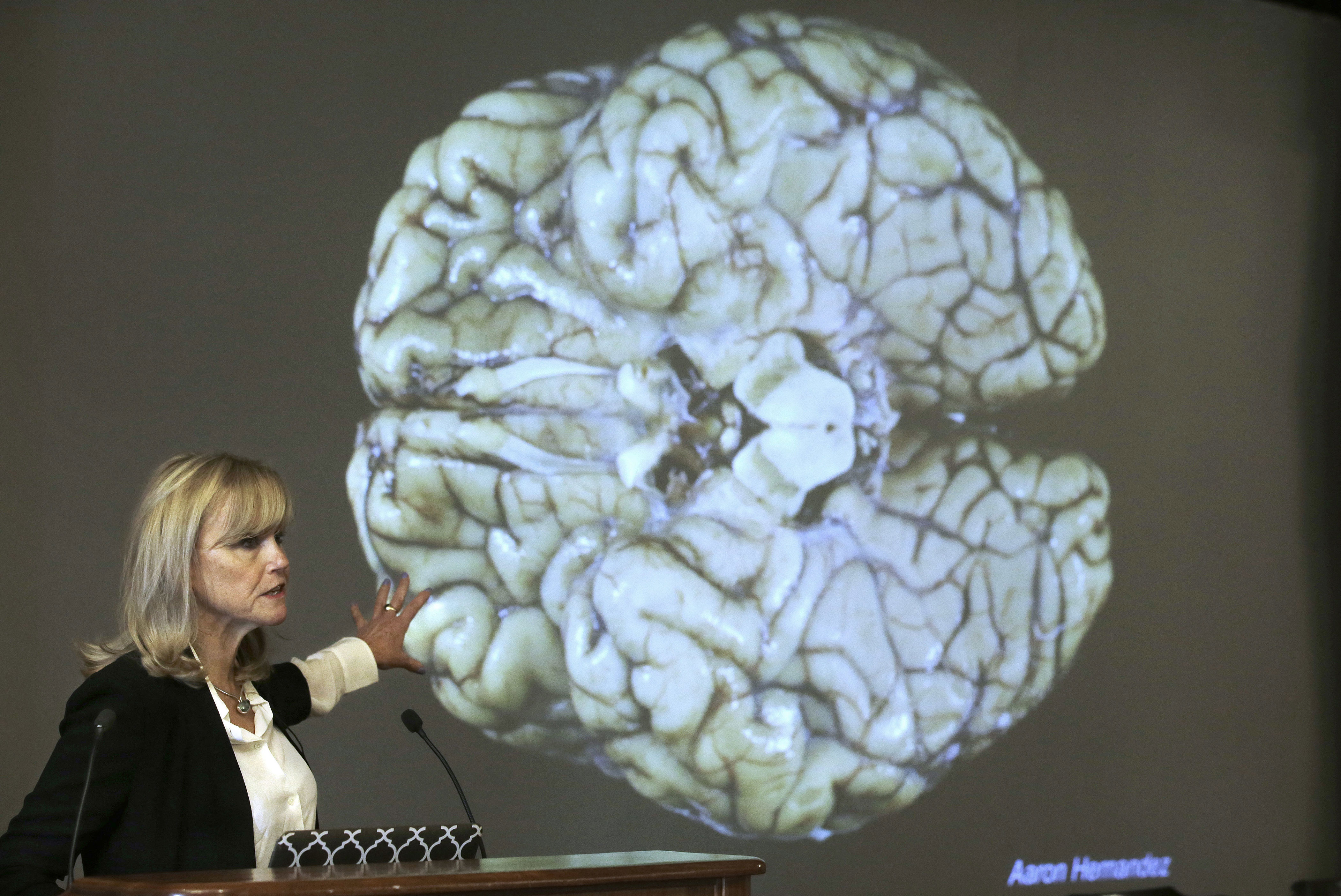 At least 1 in 4 NFL players has CTE, study finds