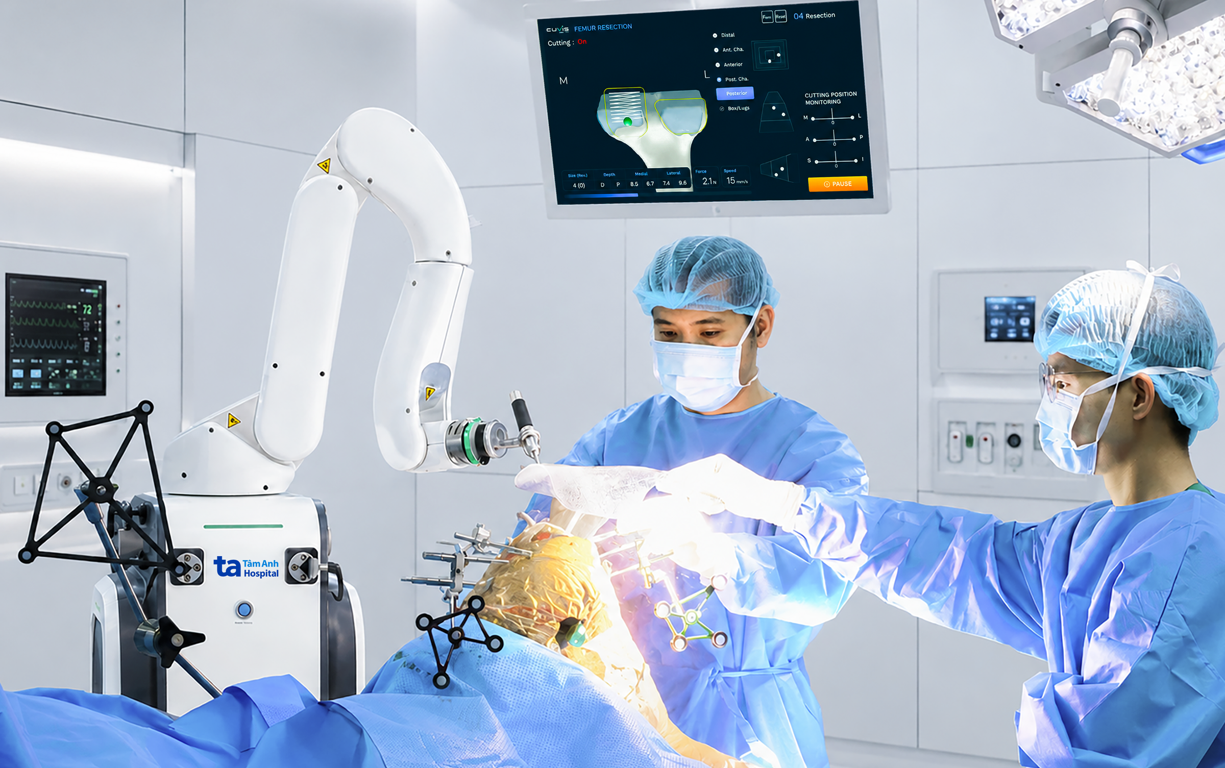 4 công nghệ nổi bật của robot AI phẫu thuật thay khớp