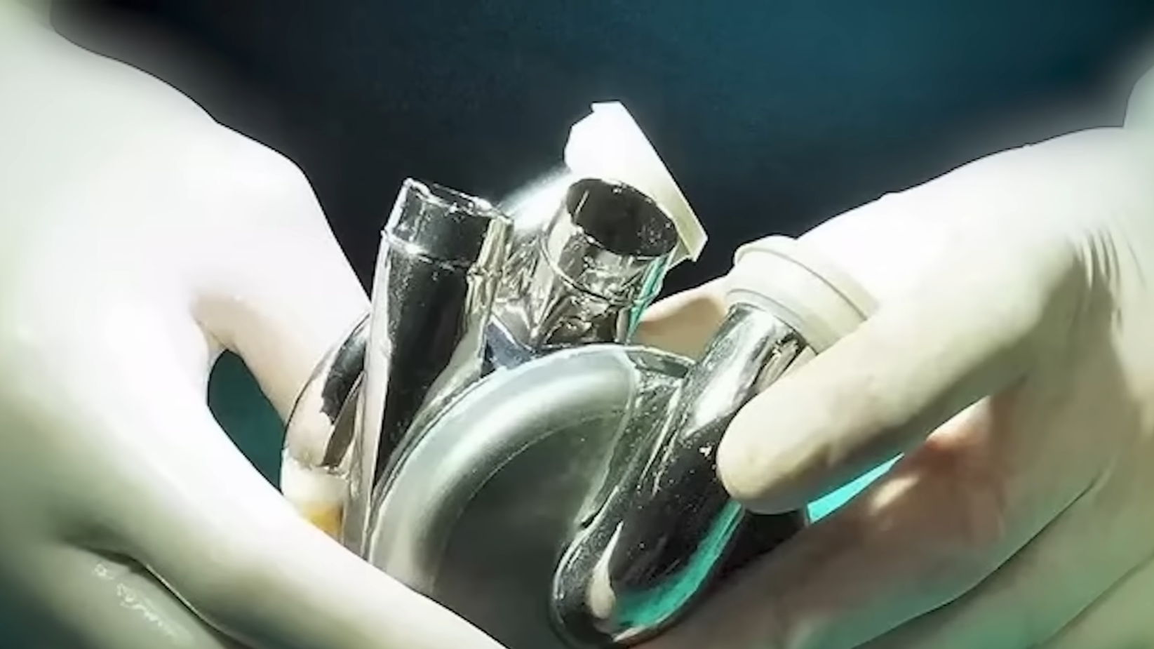 26 million people face heart failure every year - Daniel Timms’ BiVACOR ...