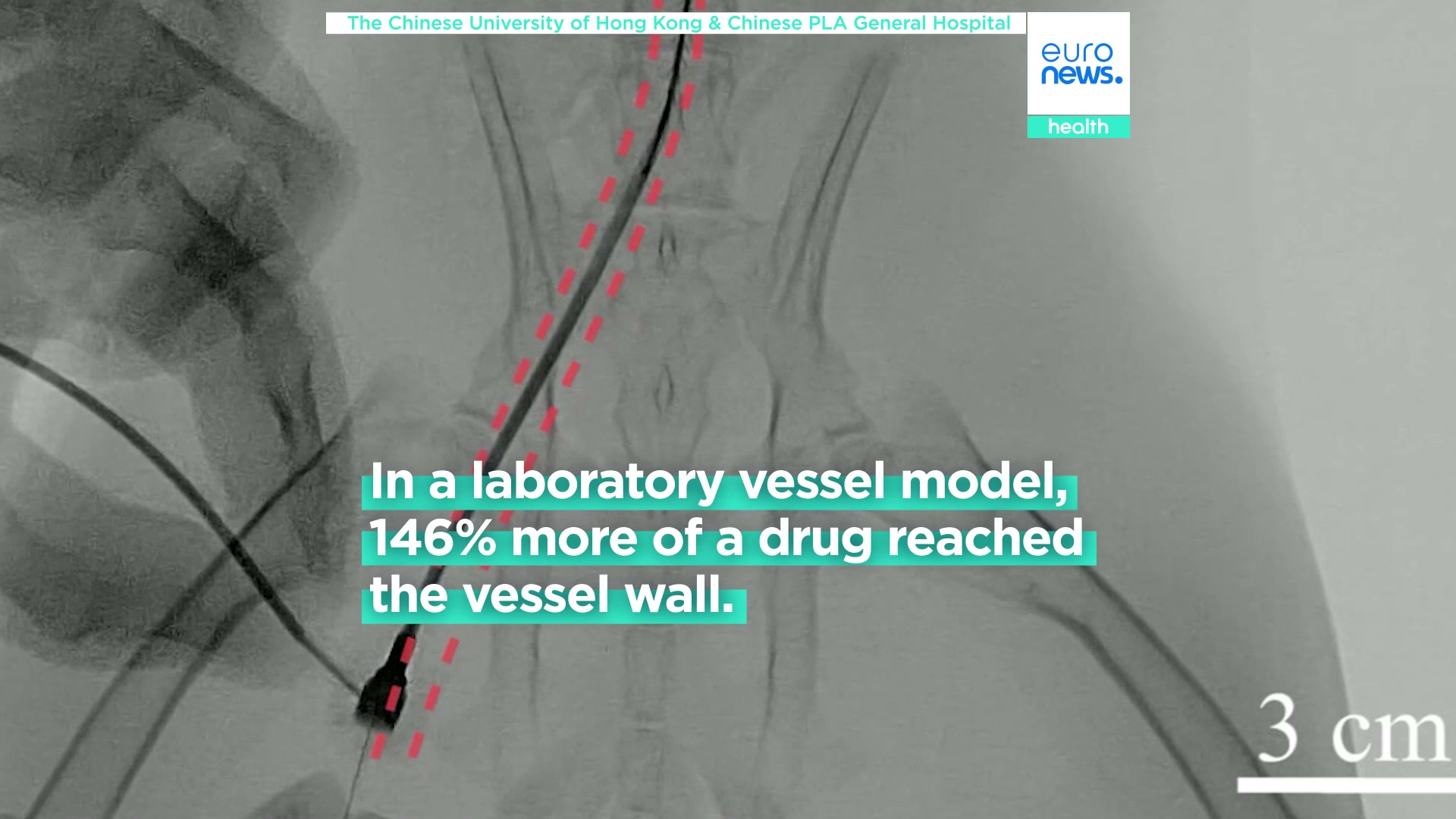 This tiny robot could help deliver drugs, dissolve blood clots and ...