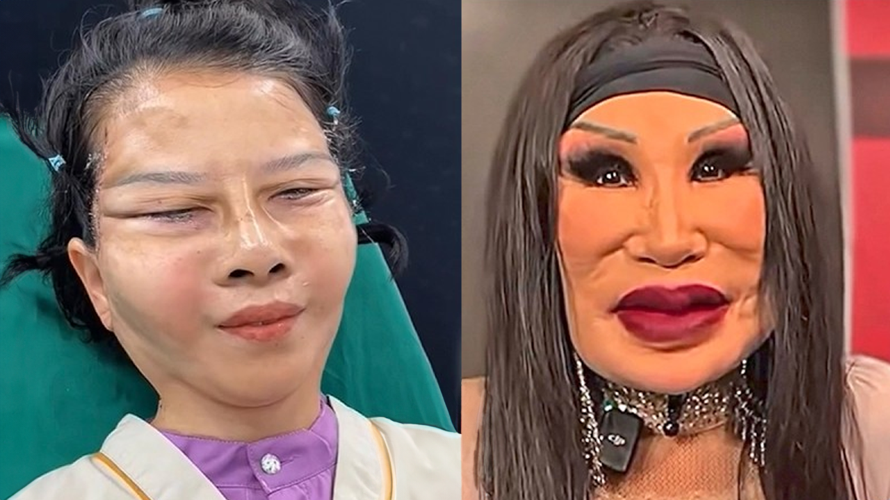 plastic-surgeon-reacts-to-bizarre-viral-plastic-surgery-tiktoks