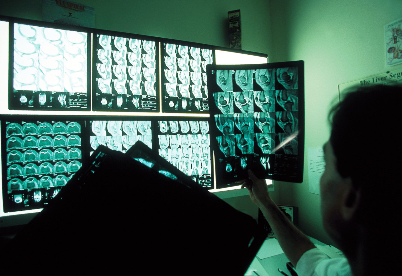 AI is helping patients solve medical mysteries