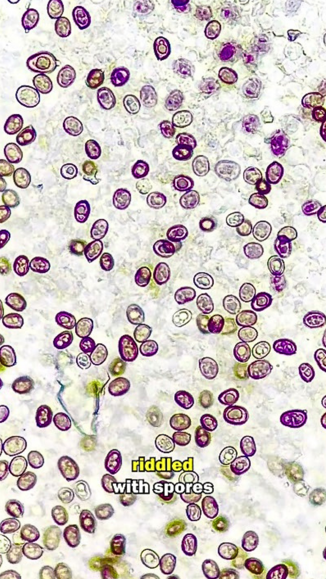 Mushroom spores under a high-powered microscope