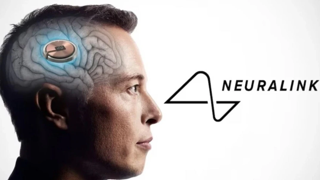 Elon Musk put a Neuralink chip in a 29-year-old man’s brain - then ...