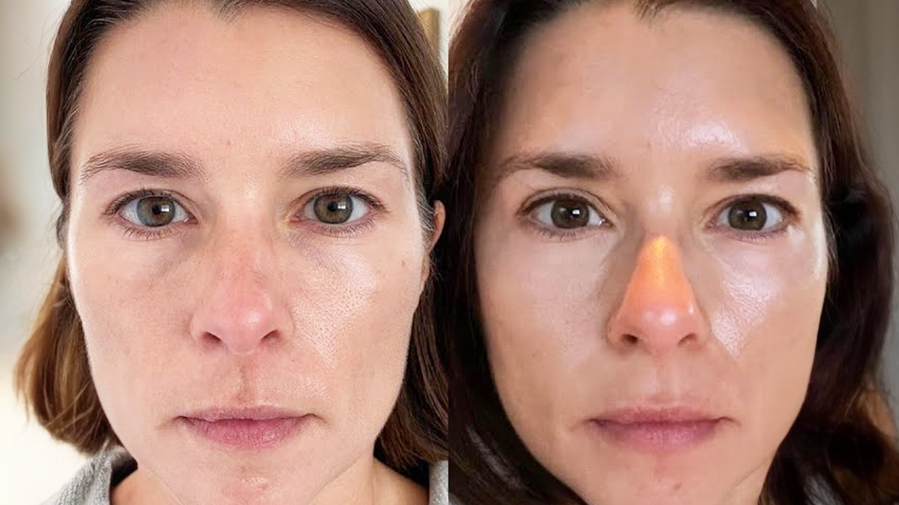 What happened with Danica Patrick’s breast implants?
