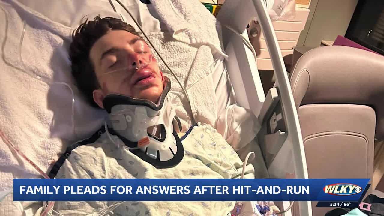 ‘It's just inhumane': 18-year-old recovering at home after hit-and-run; woman arrested