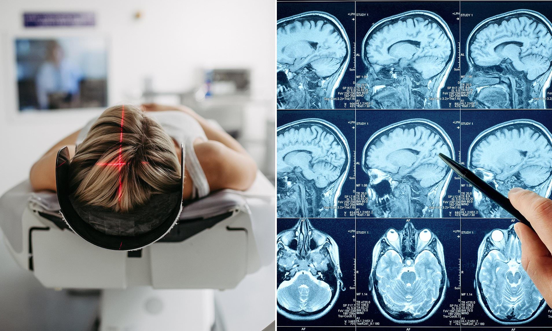 Common brain disorder suffered by millions is often dismissed as being ...
