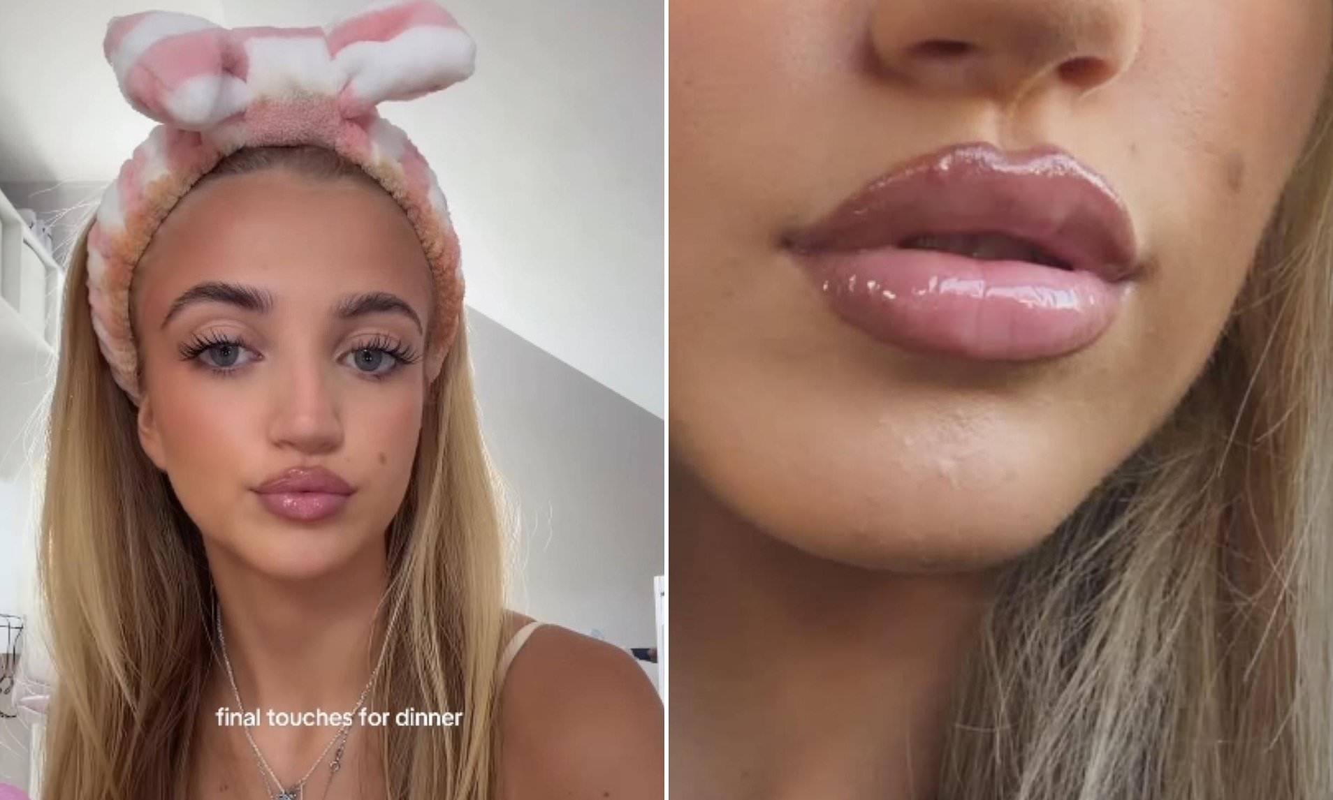 Princess Andre perfects her pout as she teases her new lip kit after Katie gets scar tissue removed