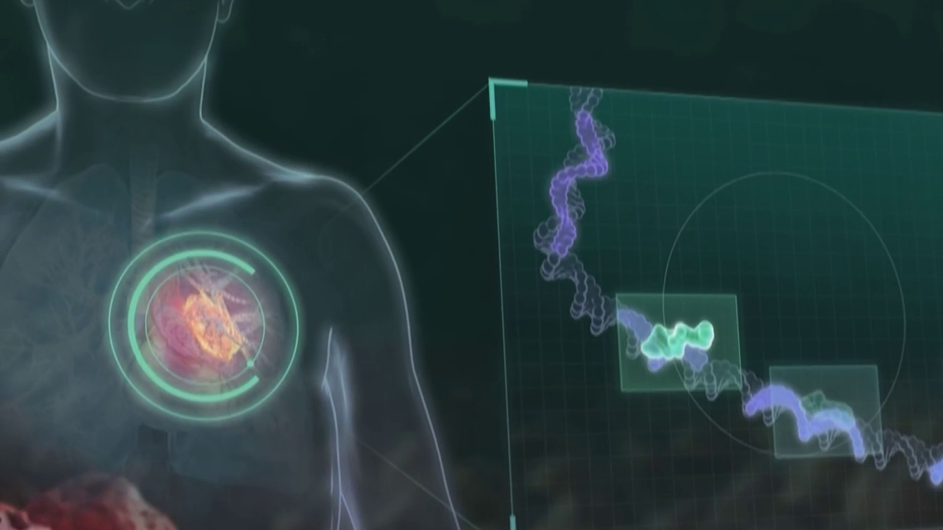 Merck and Moderna say cancer vaccine shows signs of preventing ...
