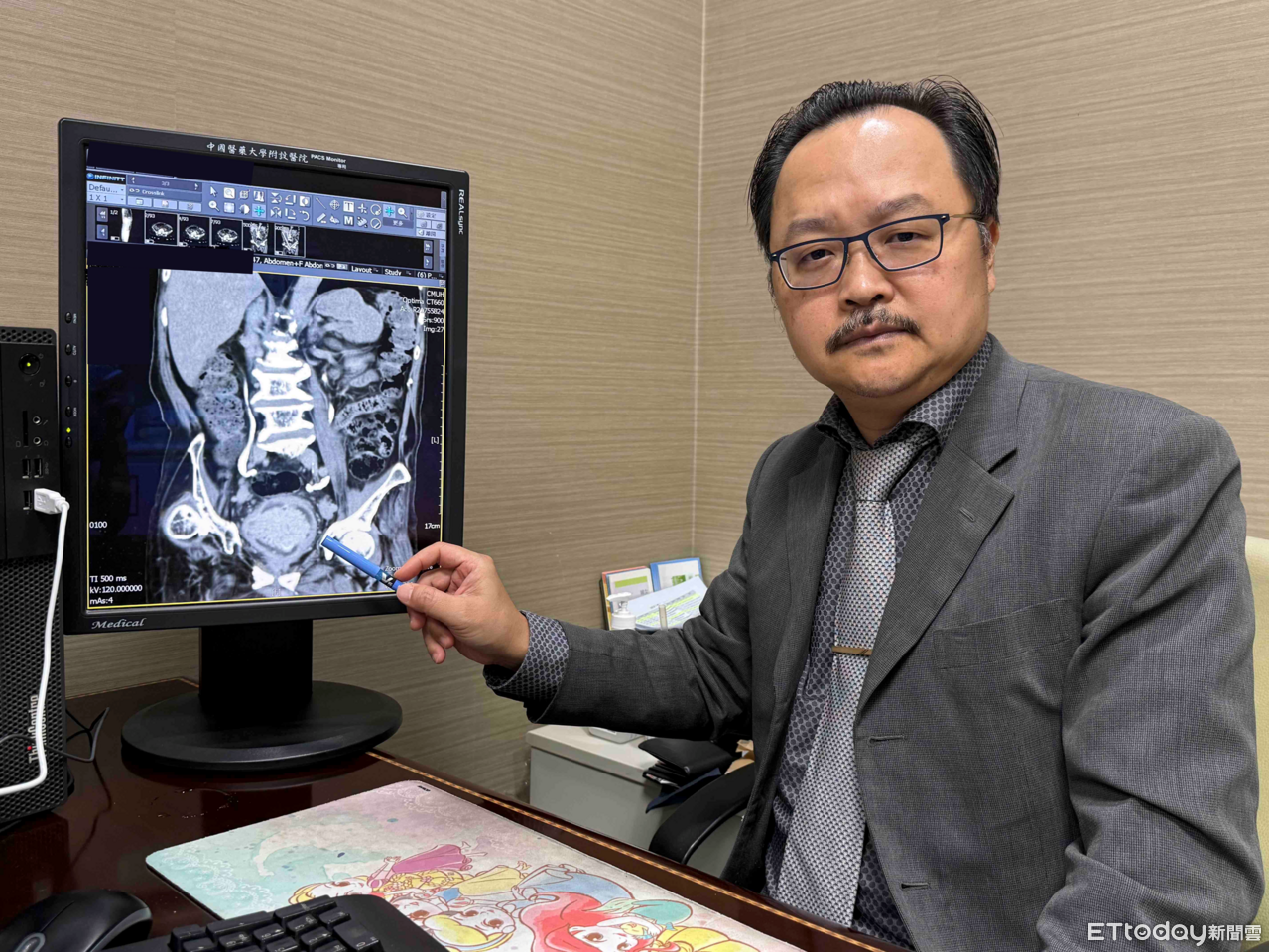 尿尿不痛卻帶血! 醫示警「膀胱癌」年增3千例：第4期存活率僅1成