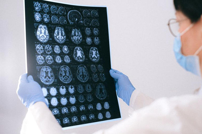 How common are brain injuries and what causes them?