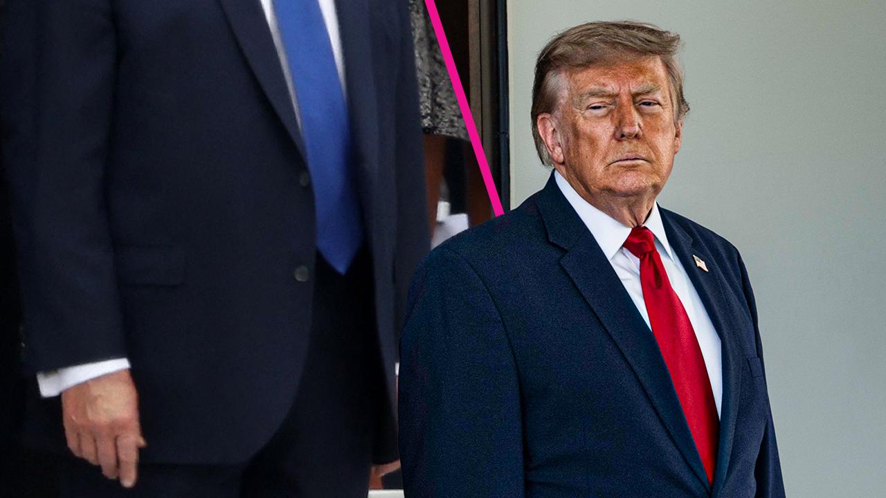 Donald Trump, 80, shows swollen, discolored hand at White House events ...