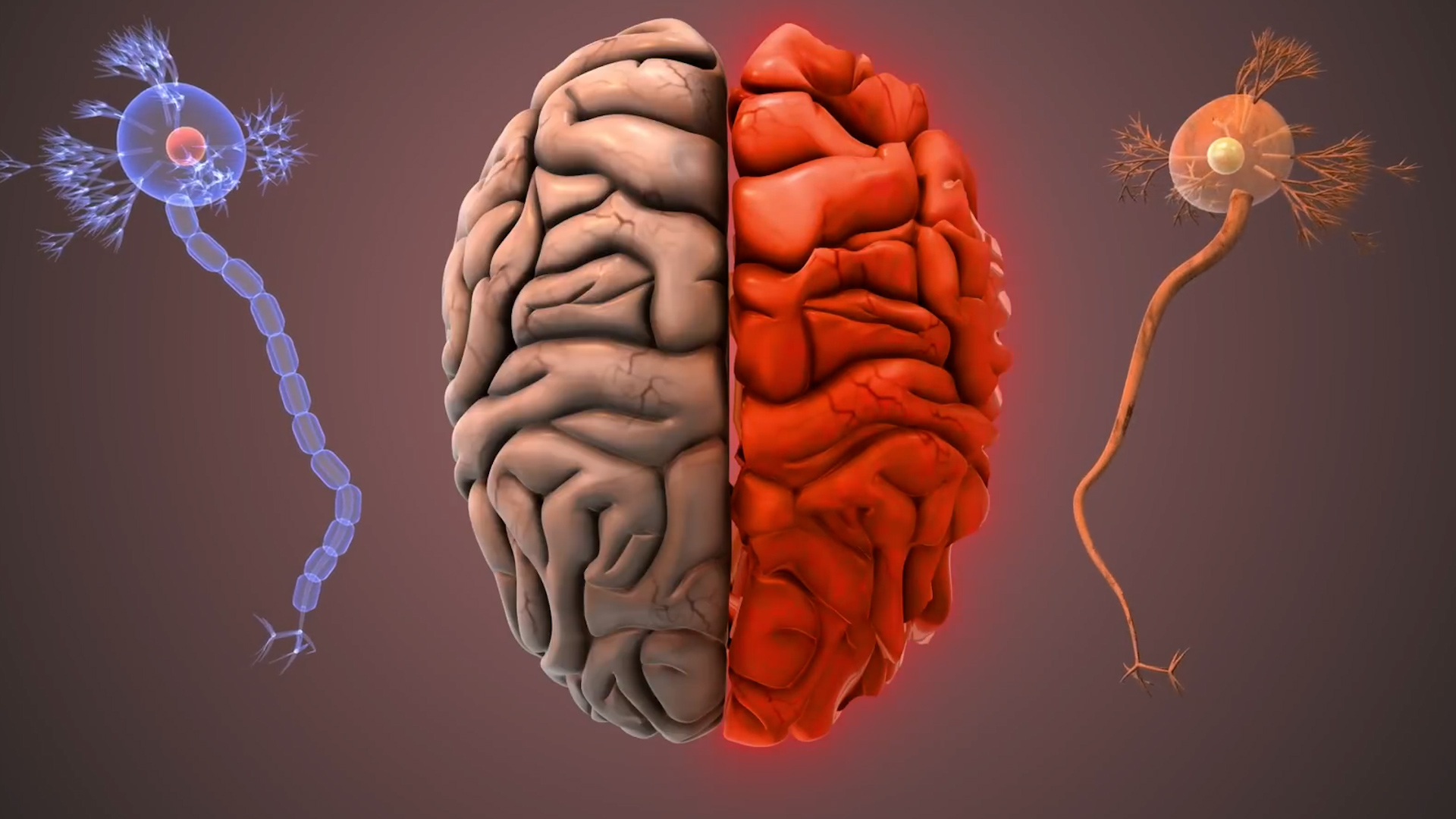 Could a common joint supplement affect Alzheimer's risk? Doctors ...