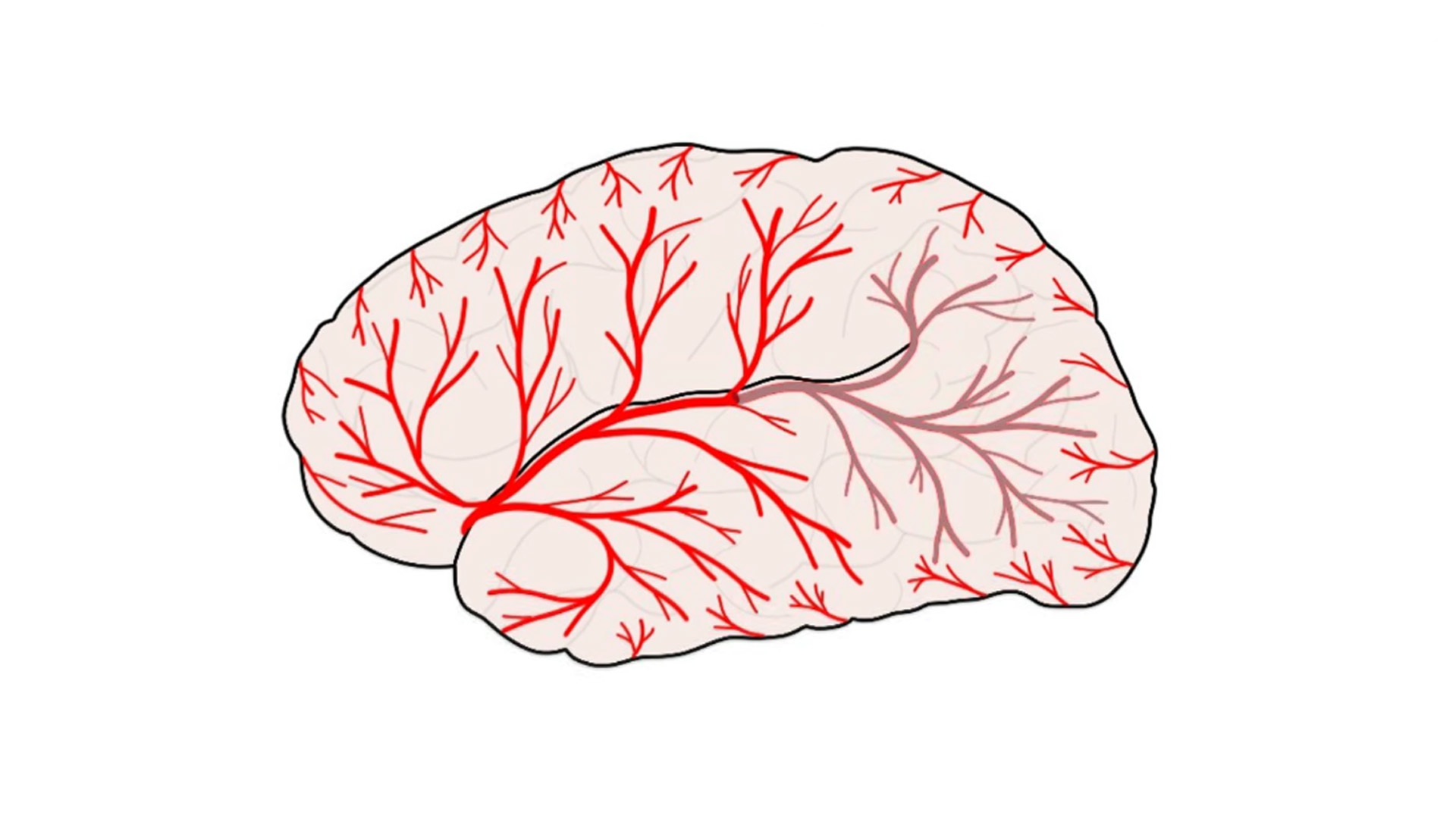 Understanding transient ischemic attacks and mini stroke differences