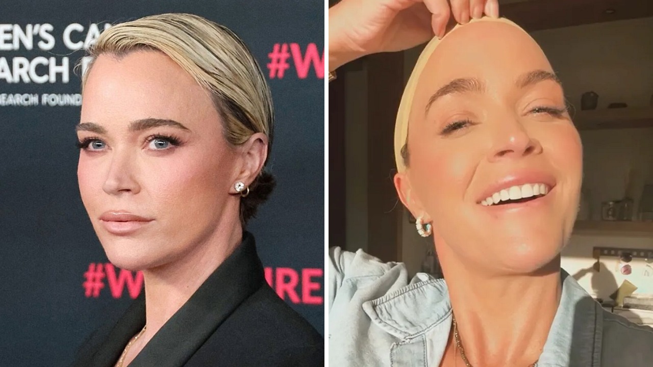 teddi-mellencamp-shows-real-hair-growth-after-chemo-admitting-that-she