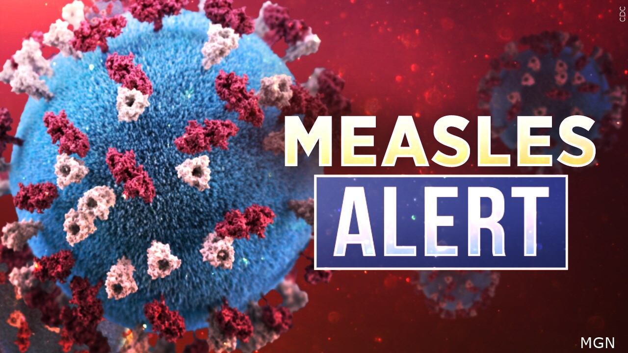 Two confirmed cases of measles in Vernon County