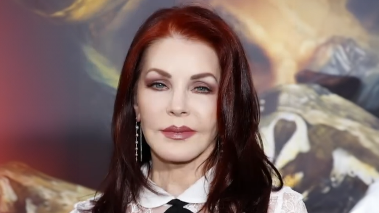5 celebrity plastic surgery results gone wrong