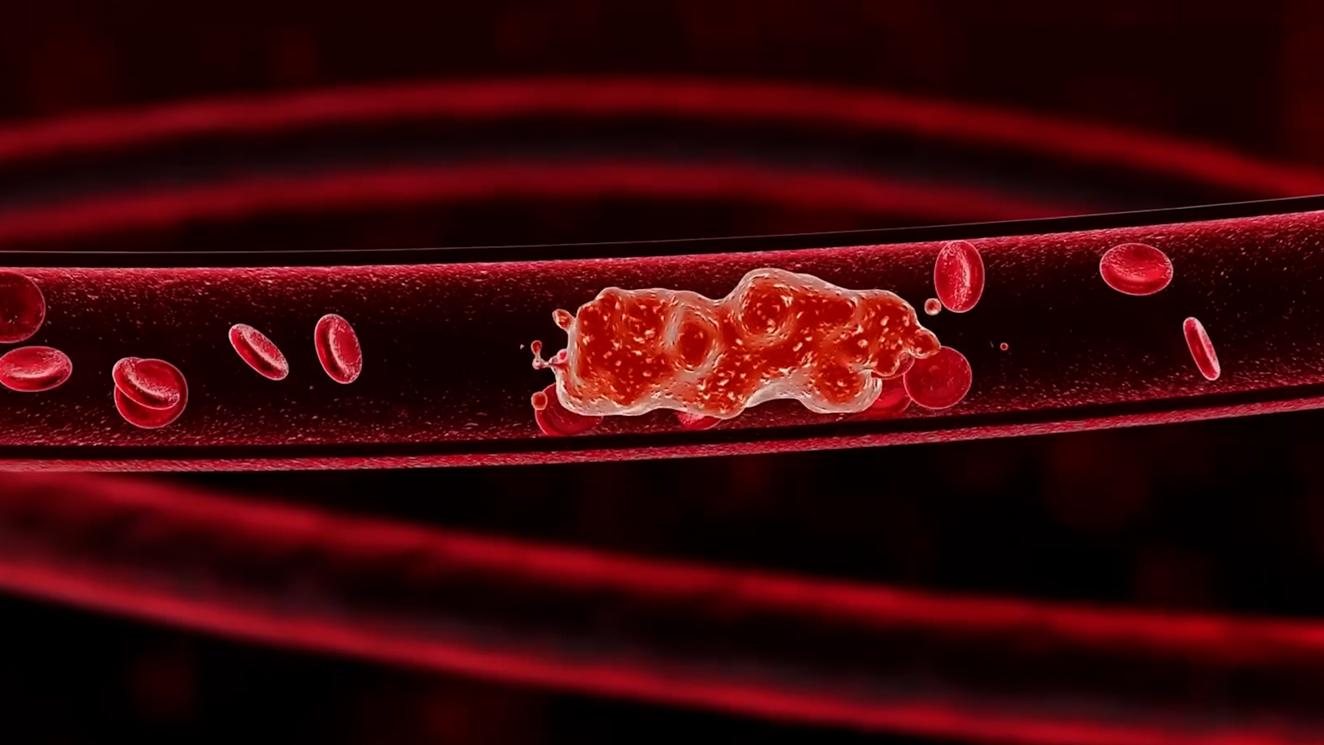 A neurologist explains stroke warning signs and what truly matters most