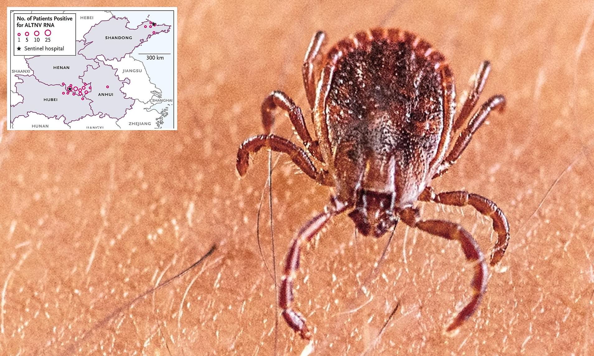 New tick-borne virus found in China after thousands tested for unexplained severe fever