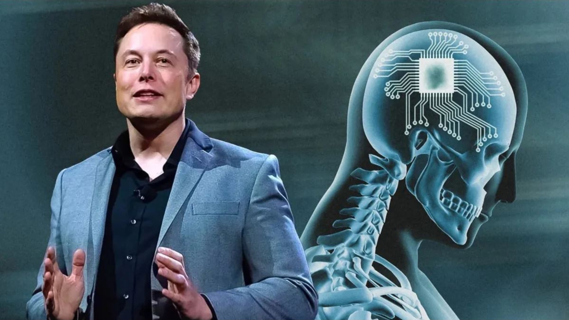 Elon Musk’s Neuralink has a 4,096-electrode problem nobody wants to ...