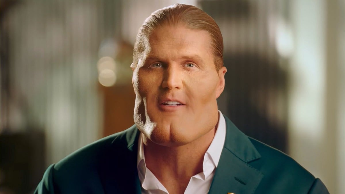 Clay Matthews finally reveals reason for fake plastic surgery photos ...
