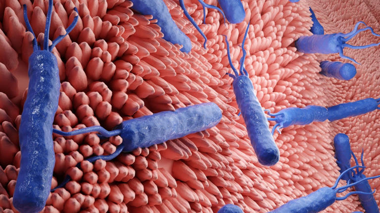 La bacteria Helicobacter pylori.