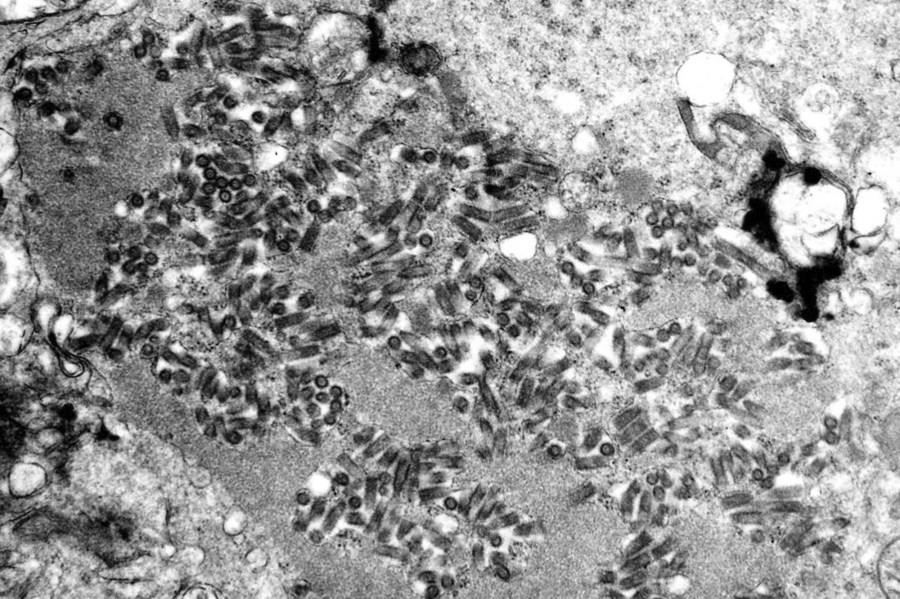 CDC warns of increase in rabies activity, human exposures across US