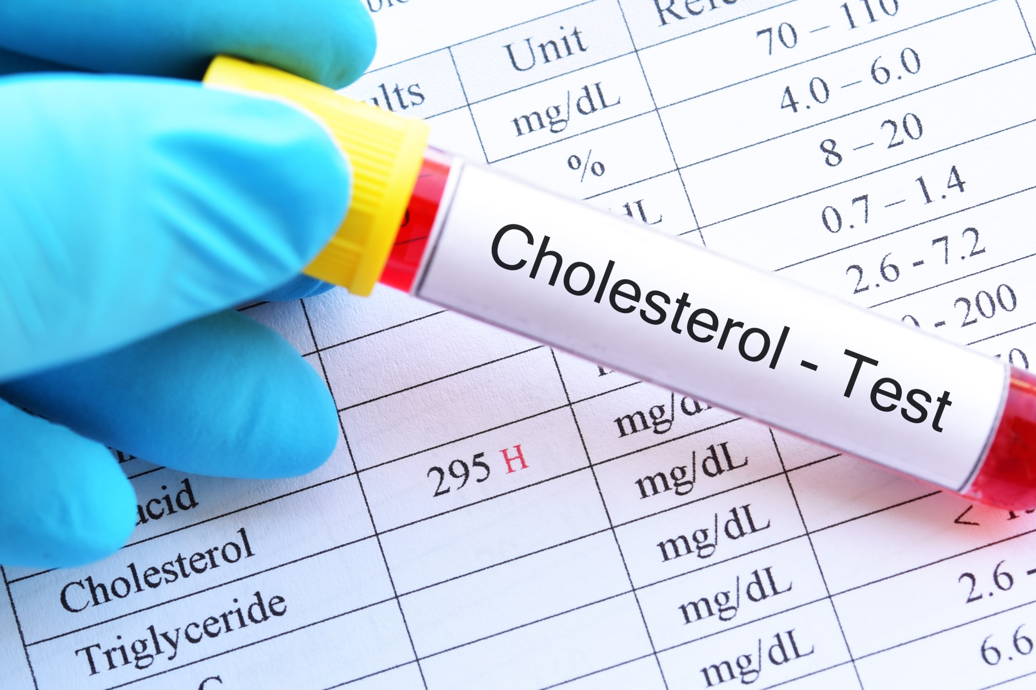 Woman baffled by cholesterol test results—then makes one simple change