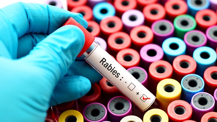 Rabies warnings issued in multiple Charlotte-area counties