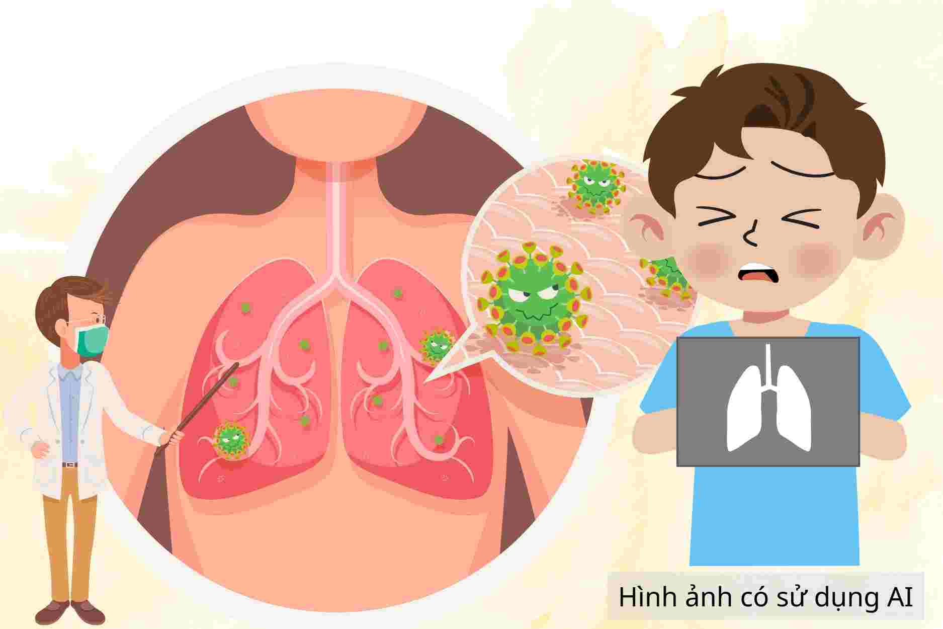 Cha mẹ cần biết 5 vaccine giúp giảm nguy cơ viêm phổi ở trẻ