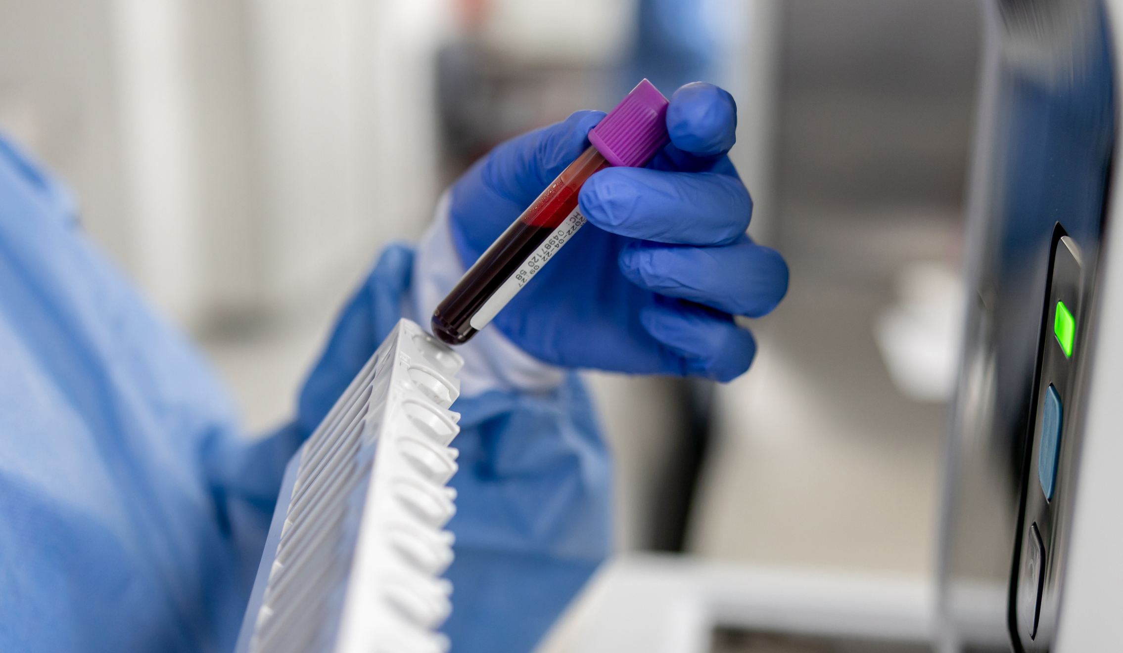 I'm an oncologist. Every man should know this about prostate cancer.