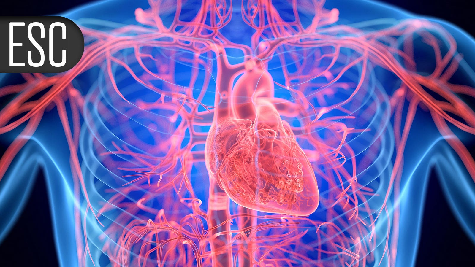 Trial delivers good news for pulmonary embolism treatment