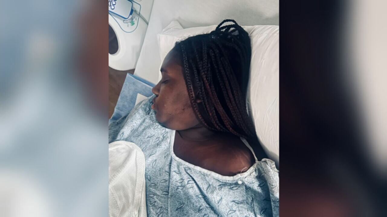 Mother accused of handing golf club to teen during fight that fractured girl's skull