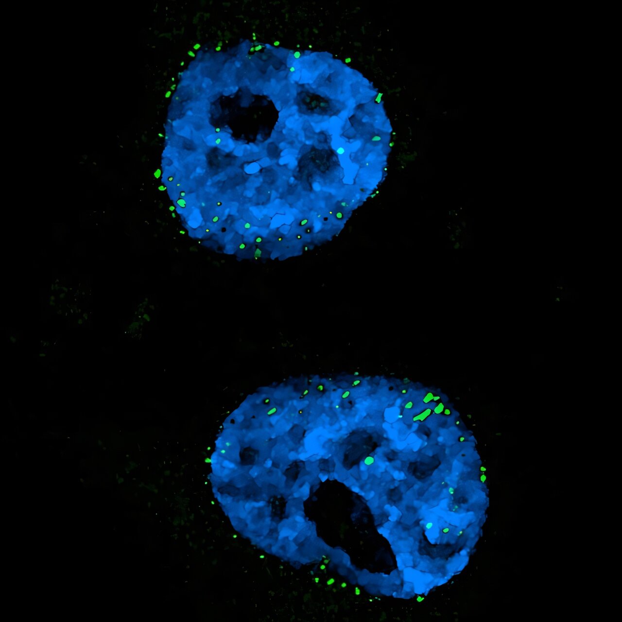 New screening platform links molecule clusters to neurodevelopmental disorders