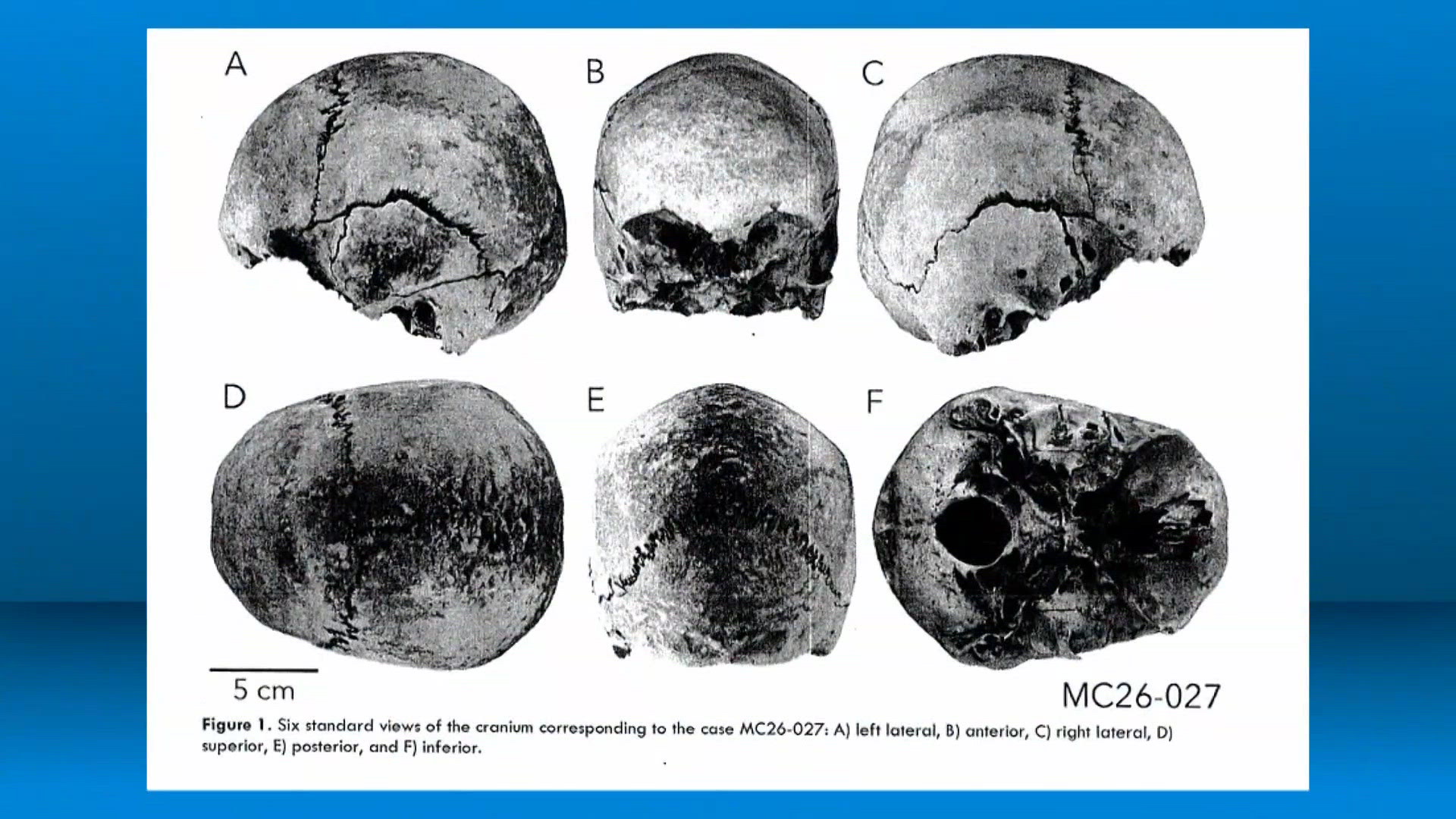 Human skull found in Cuyahoga River this summer remains unidentified