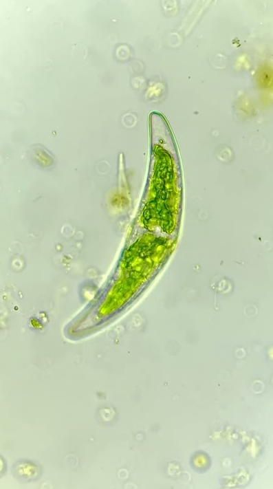 What rainforest water reveals under the microscope
