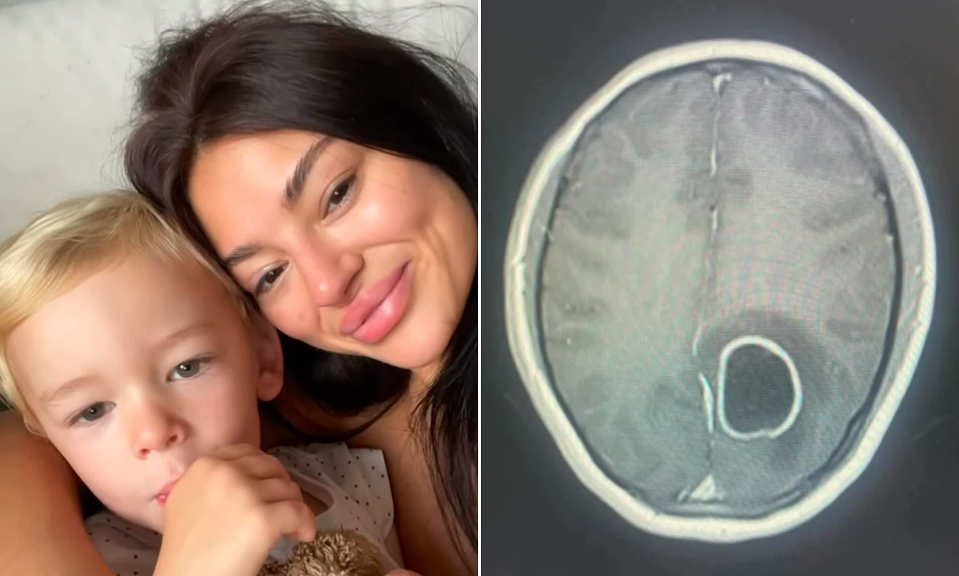 girlfriend-of-paul-gascoigne-s-son-shares-scan-of-her-brain-tumour-as