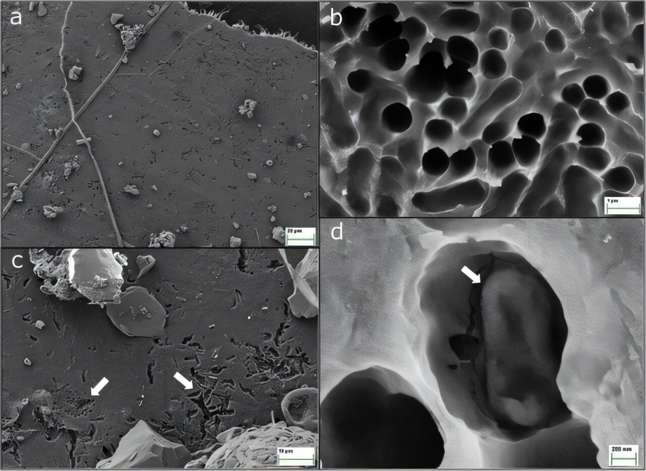 'Pac-Man' enzyme breaks down bioplastics and penicillin in laboratory tests