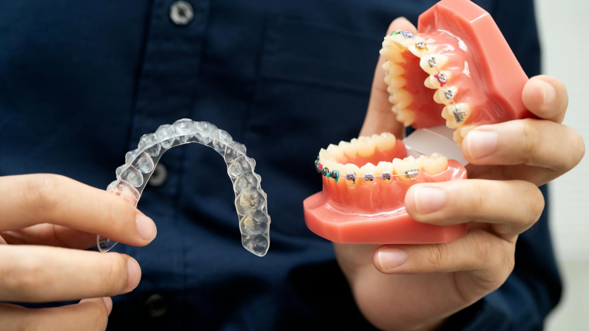 Invisalign or braces: Which option is right for you?