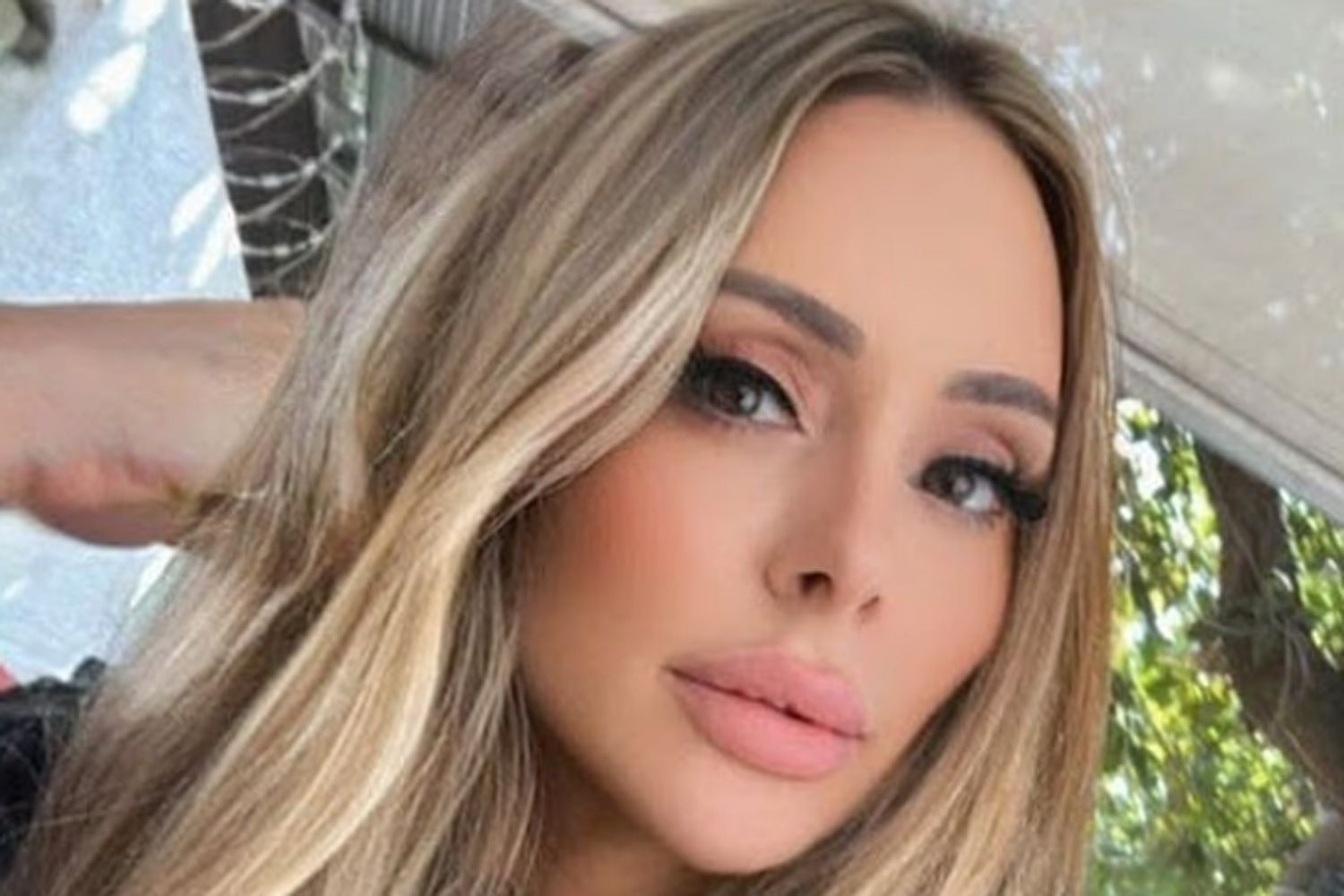 Woman, 51, dies after undergoing 6 cosmetic procedures, including facelift and liposuction, during 8-hour surgery