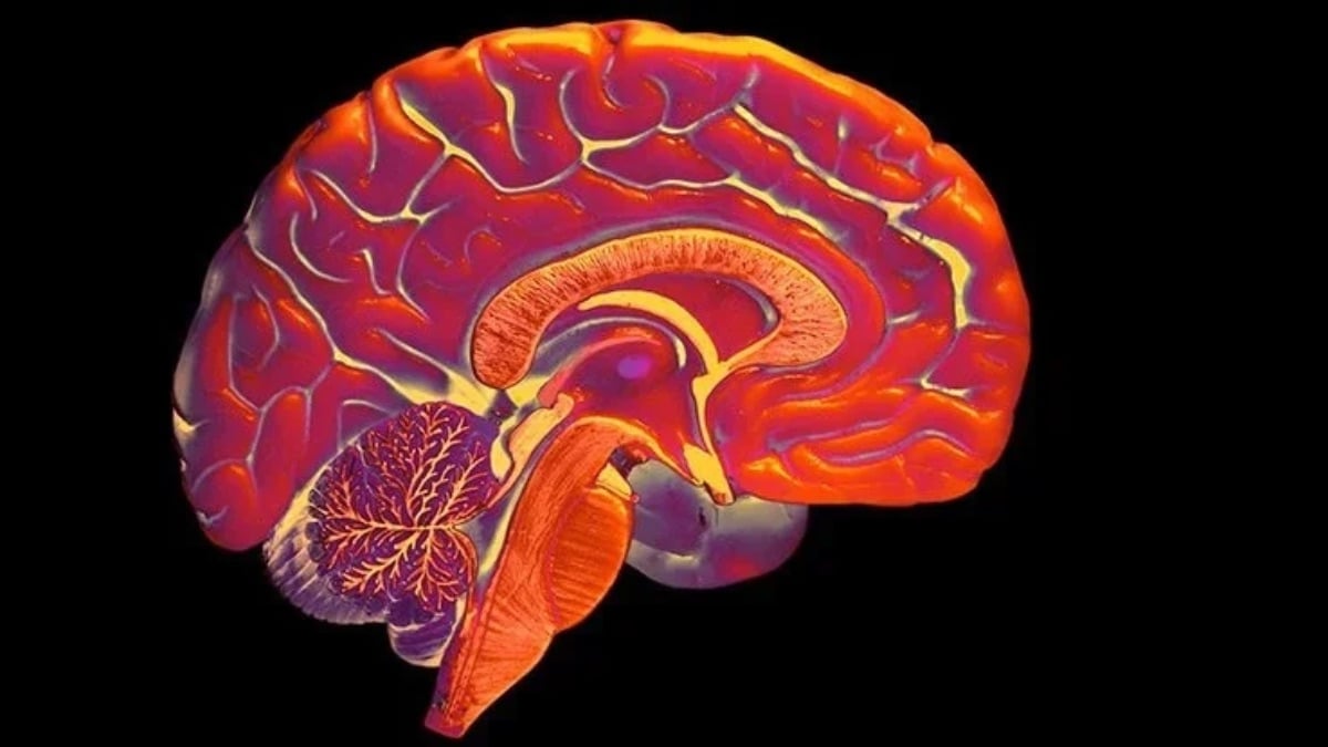 Lifelong deafness could rewire a person's peripheral vision
