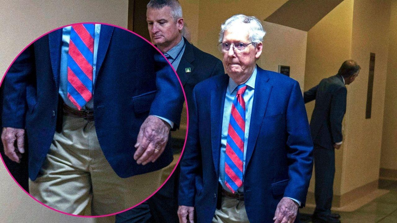 Donald Trump and Mitch McConnell hand bruises renew health questions ...